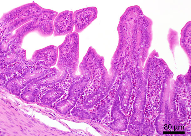 Гистологическое сечение тонкой кишки. В слизистой оболочке находятся несколько эозинофильных гранулоцитов.