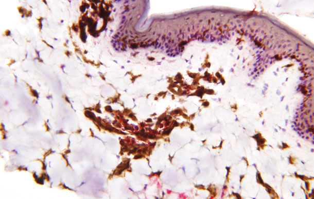 The distribution of dendritic cells in the epidermis, dermis and subcutaneous tissue in the pig