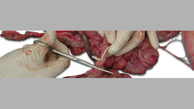 Завяжите концы кишечного отдела перед отрезанием
