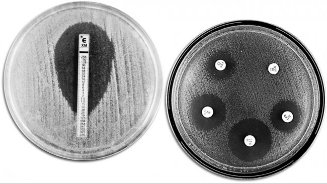Классические методы для оценки антимикробной резистентности. Рисунок с левой стороны показывает Е-TEST для измерения минимальной концентрации антибиотика, который предотвращает бактериальный рост. Правая сторона показывает тест на определение чувствительности микроорганизмов к антимикробным препаратам с различными зонами подавления роста, вызванными действием антибиотиков.
