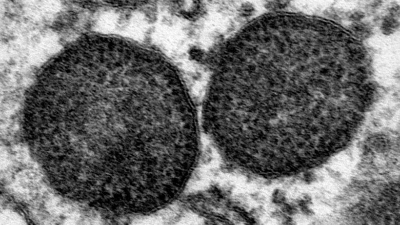 Электронная микрофотография двух внутриклеточных телец в цитоплазме макрофага, включая очень большое количество корпускул ЦВС-2. 150.000x. Источник: Каролина Родригес-Кариньо, Исследовательский центр здоровья животных.
