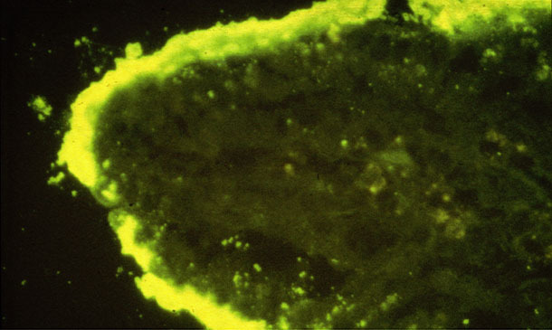 Плотные колонии E. coli прикреплены на кишечной ворсинке (IFA).

