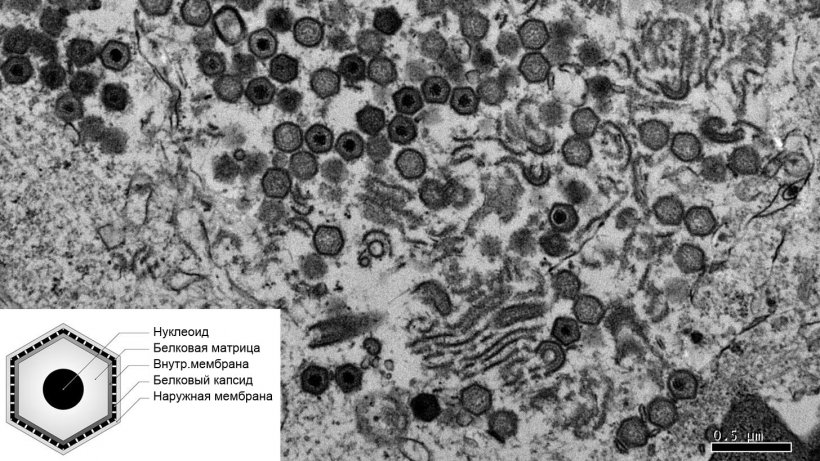 Изображение клетки, зараженной вирусом АЧС, на электронном микроскопе.

