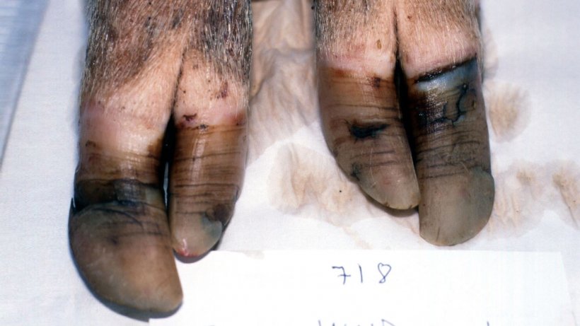 Изображение 6. Задняя нога свиноматки второго опороса, содержавшейся на выгуле, с чрезмерным и неравномерным разрастанием копытец, с горизонтальными трещинами.
