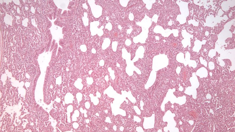 Фото2: Интерстициальная пневмония, характеризуемая утолщением альвеолярных стенок при заражении вирусом РРСС.
