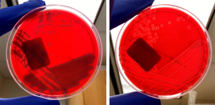 Негемолитический E coli (слева) и гемолитический E coli (справа).
