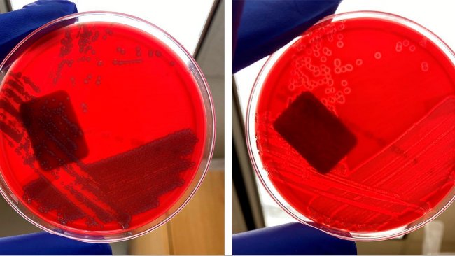 Негемолитический E coli (слева) и гемолитический E coli (справа).
