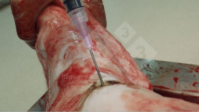 Фото 1. Отбор образца суставной жидкости у мертвой свиньи.&nbsp;&nbsp;Кожа удалена и с помощью шприца сбор суставной жидкости происходит в стерильных условиях.
