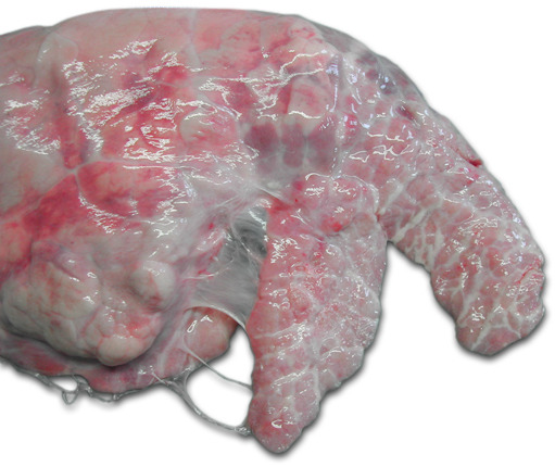  Правое легкое свиньи. Хронический кранио - вентральный плеврит, затрагивающий сердечную долю и краниальную часть диафрагмальной доли.
