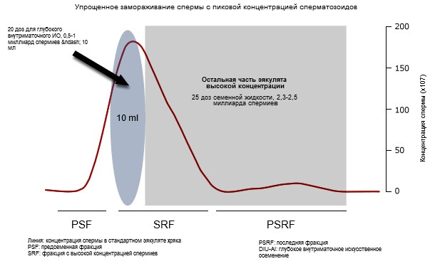 Стандарт. эякулят представлен 3 различ. фракциями (PSF, РВСН и PSRF) в зависимости от концентрации сперматозоидов в числе др. параметров (красная линия).