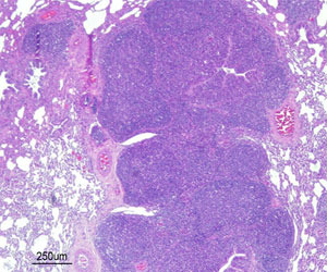 Бронхо-интерстициальная пневмония с бронхоальвеолярной гиперплазией лимфоидной ткани (БАЛТ), вызванная экспериментальным заражением Mycoplasma hyopneumoniae.   