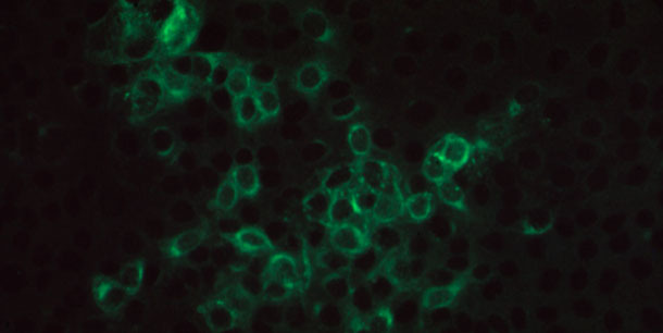 Микрофотография положительной иммунофлуоресценции на инфицированный вирусом РРСС монослой клеток MARC145, инкубированный свиной сывороткой, содержащей специфичные антитела IgG вируса РРСС, и помеченный козьими анти-свиными антителами IgG, сопряжёнными с флуоресцентным красителем