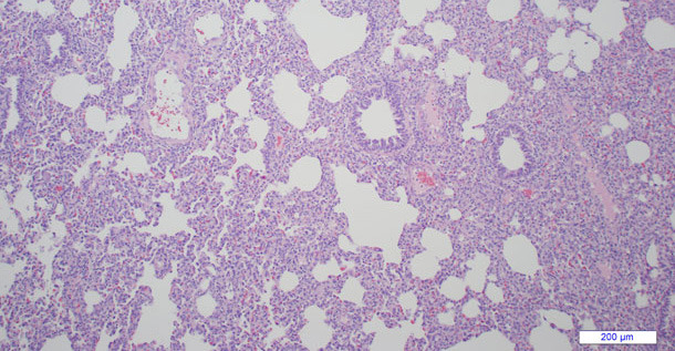 Figure 2. Microscopic lung lesion